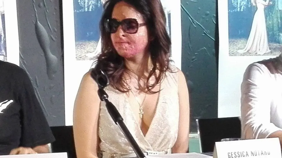 Gessica Notaro 

