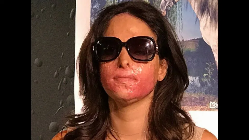 Gessica Notaro