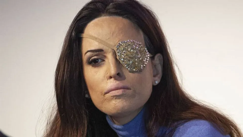 la showgirl Gessica Notaro