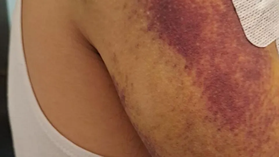 il braccio dell’uomo dopo i fendenti
